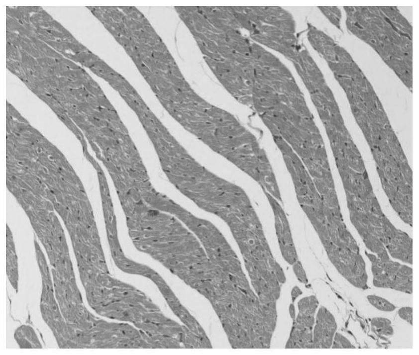 Preparation method of medicine containing betel nut and its anti-hypoxia application