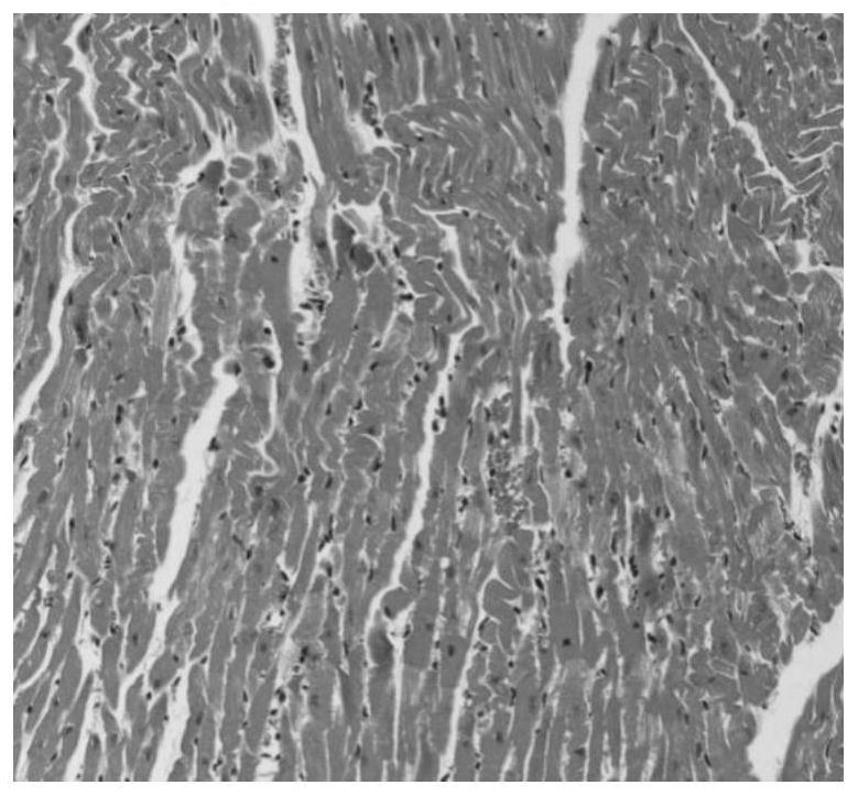 Preparation method of medicine containing betel nut and its anti-hypoxia application