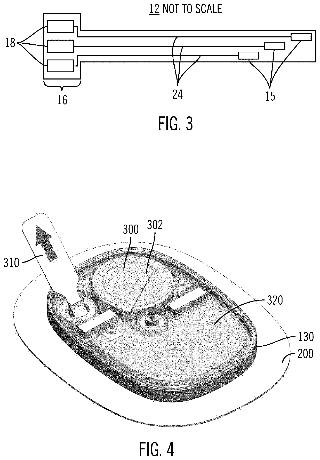 Analyte sensor