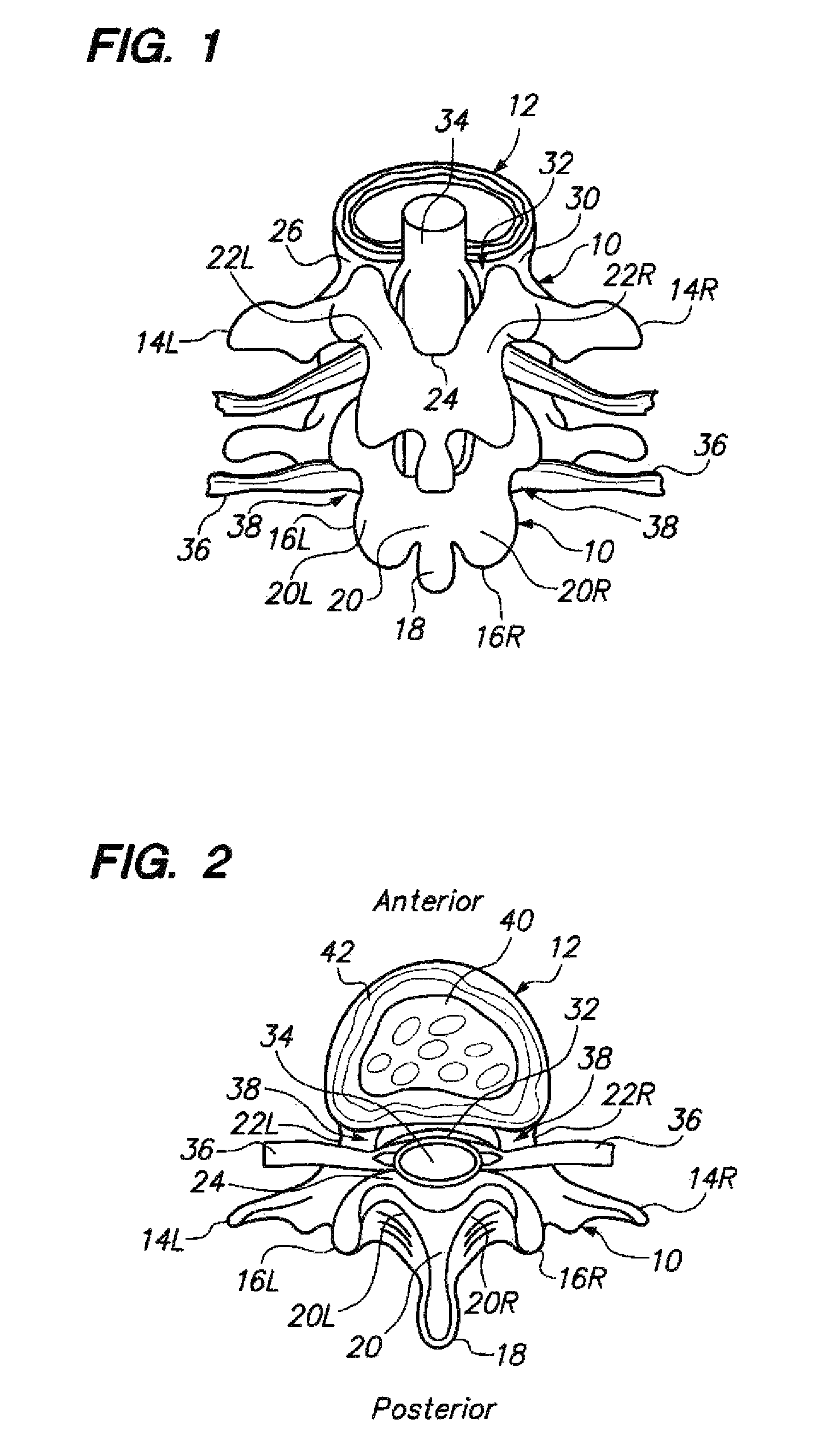 Slidable sheaths for tissue removal devices