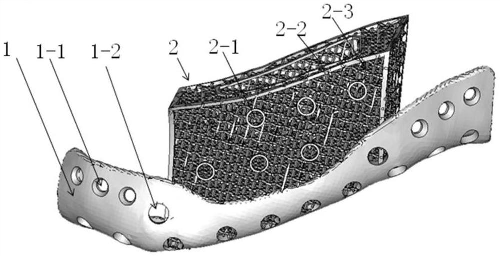 Implant for maxillofacial bone defect repair, and preparation method of implant