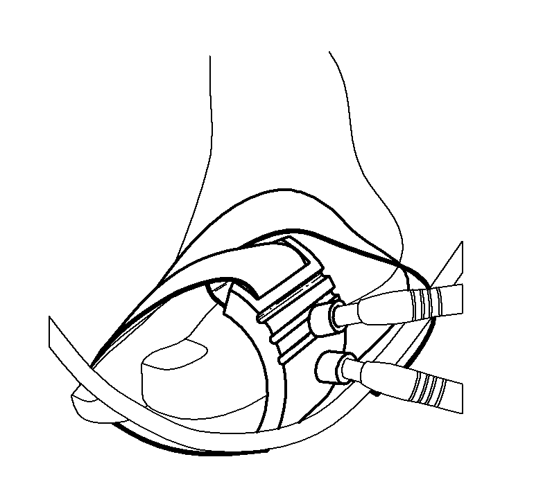 Systems and methods for pedal revascularization assessment