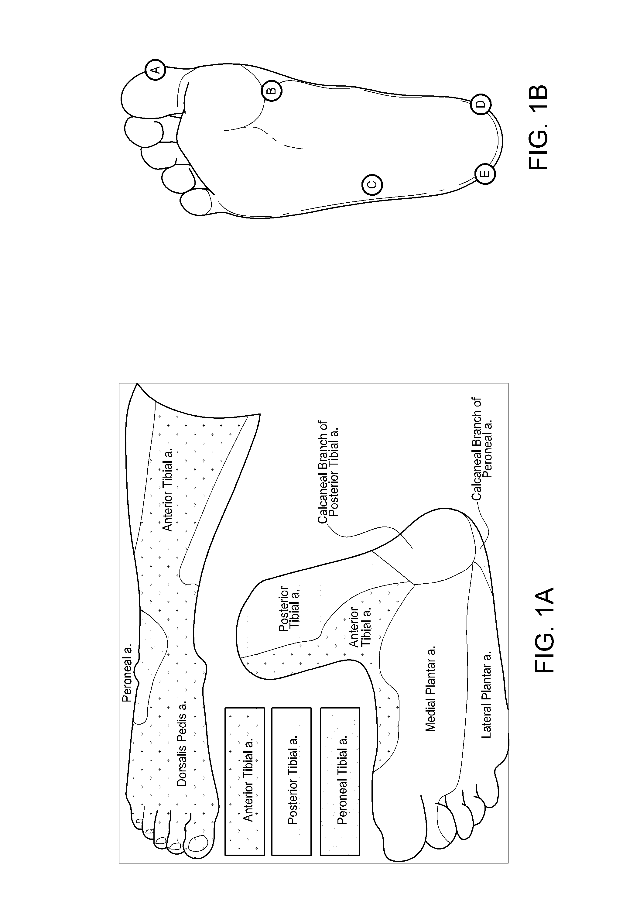 Systems and methods for pedal revascularization assessment