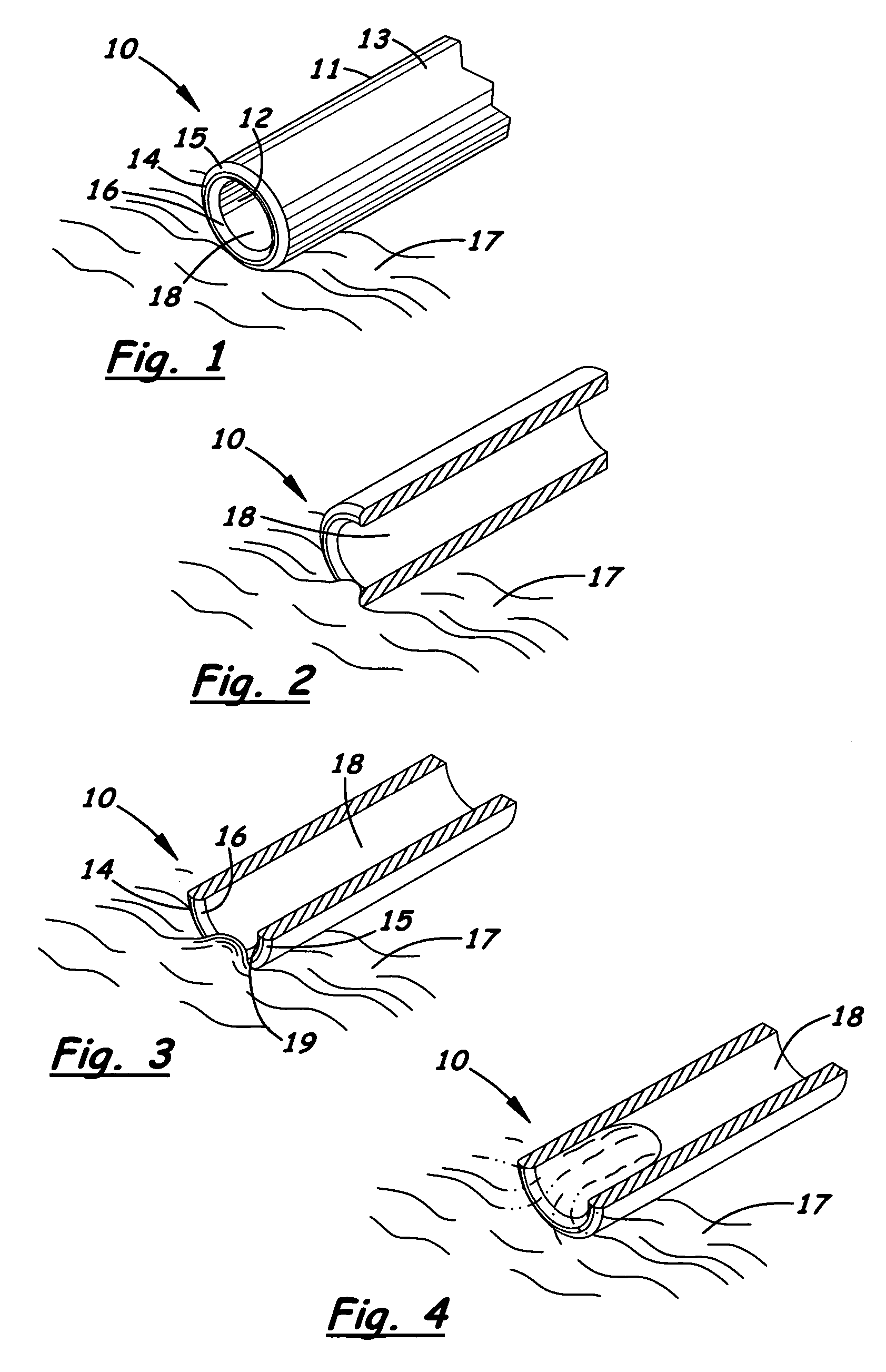 Phacoemulsification device having rounded edges