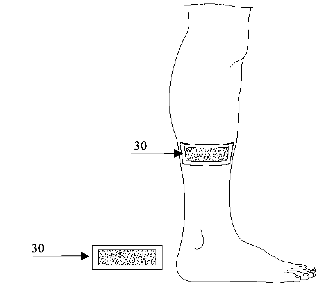 Cosmetic Treatment With Nitric Oxide, Device For Performing Said Treatment And Manufacturing Method Therefor