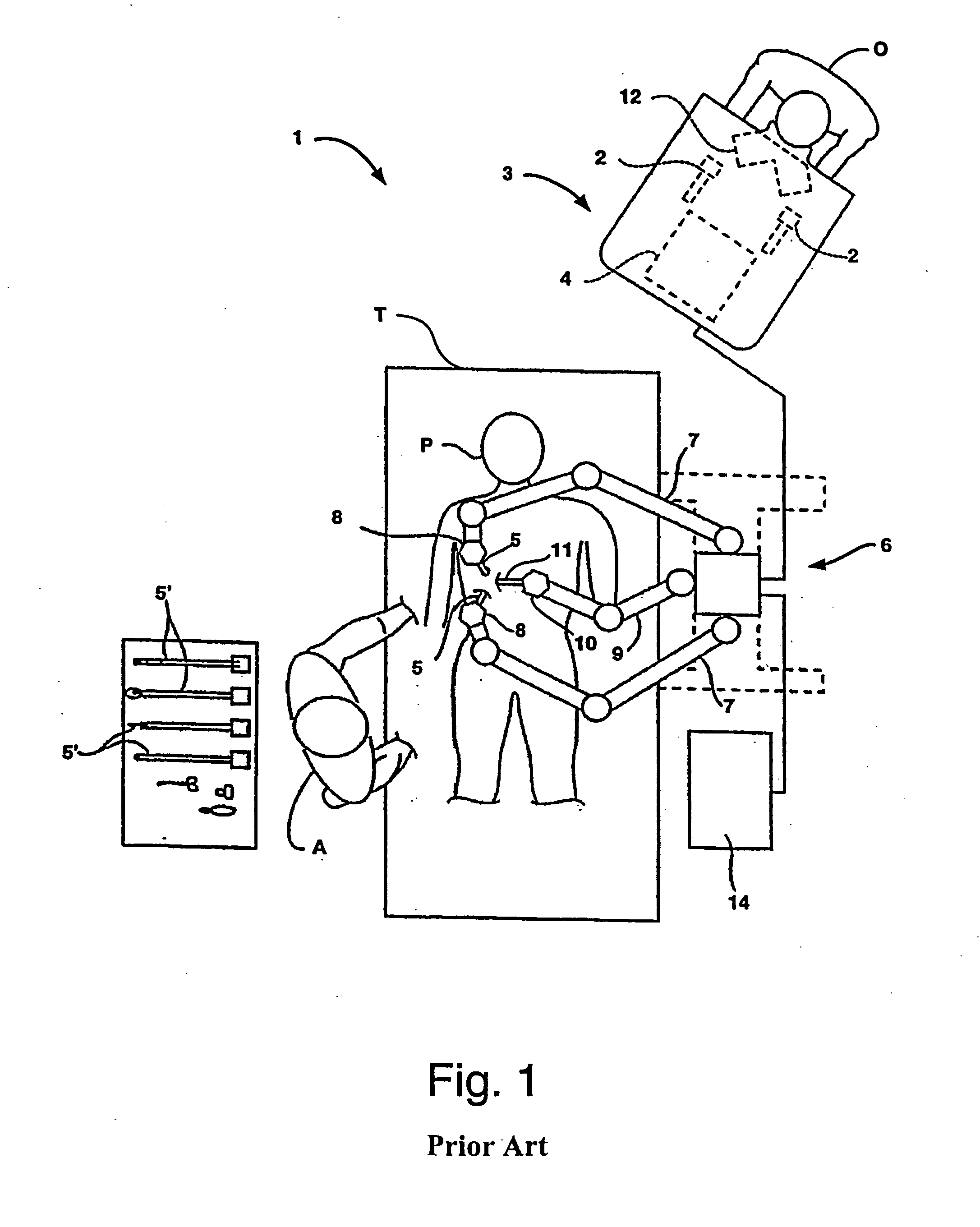 Offset remote center manipulator for robotic surgery