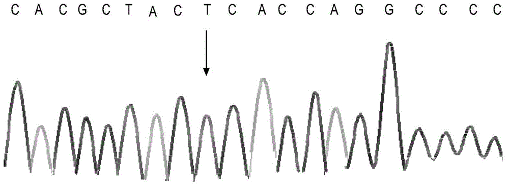 Kit and method for detecting polymorphism of CYP2D6 gene