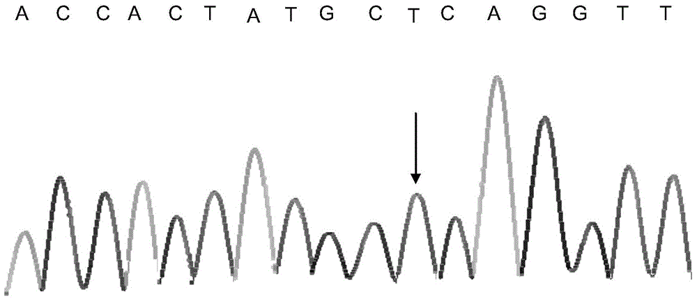 Kit and method for detecting polymorphism of CYP2D6 gene