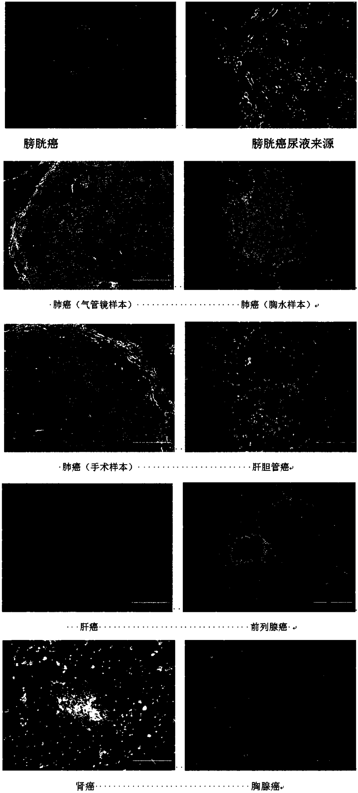 Primary tumor cell culture medium, culture method and application