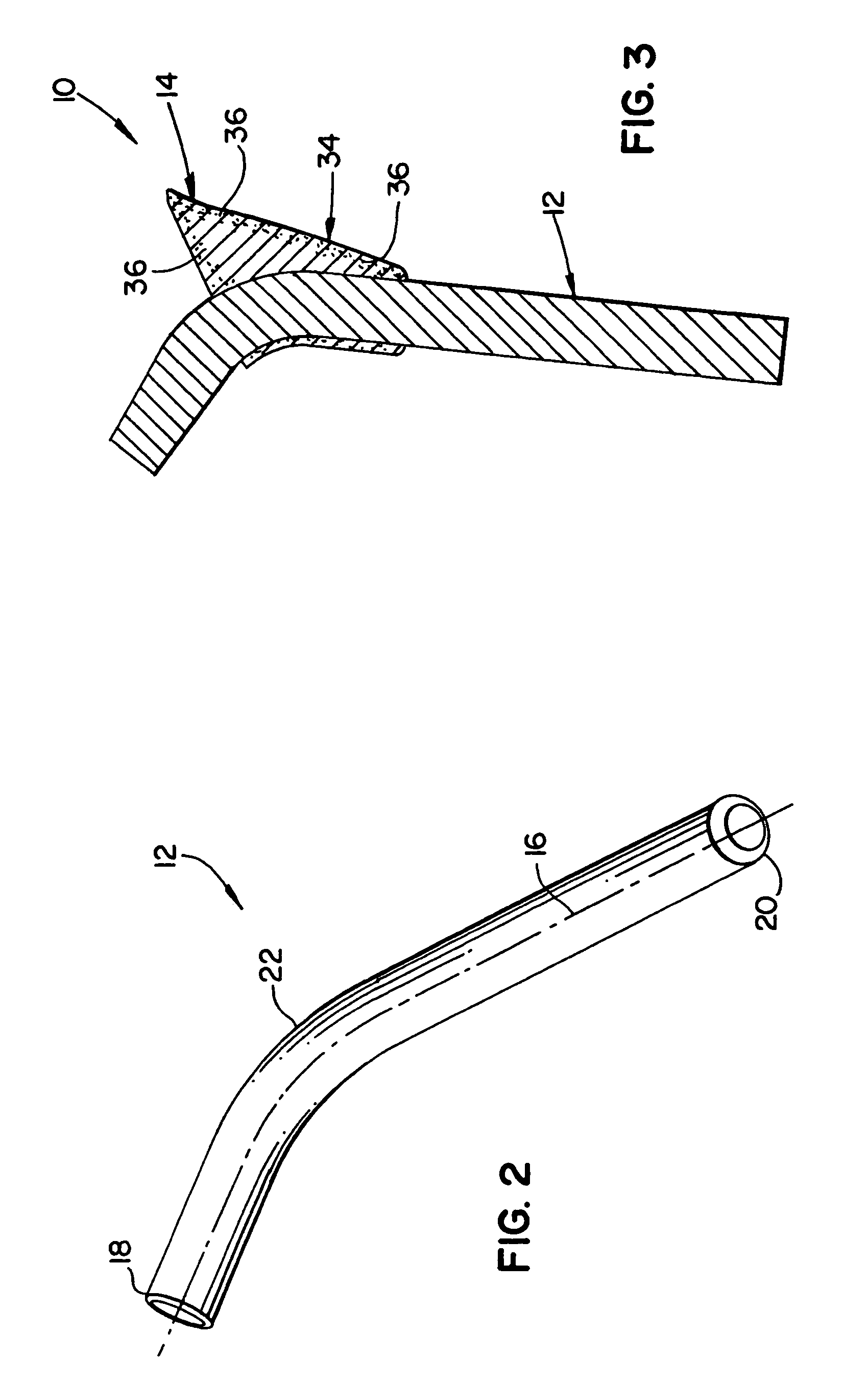 Implantable orthopedic prosthesis with textured polymeric surfaces