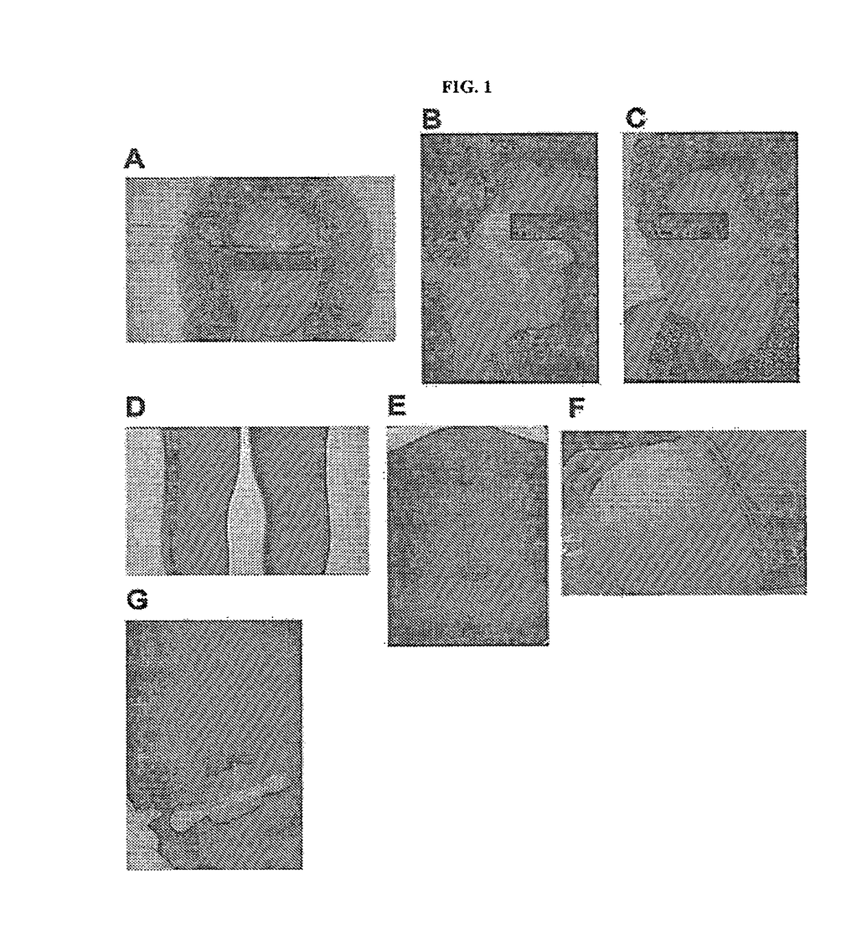 Compositions and methods for decreasing, or preventing or reversing gain of, skin pigmentation in a mammalian subject