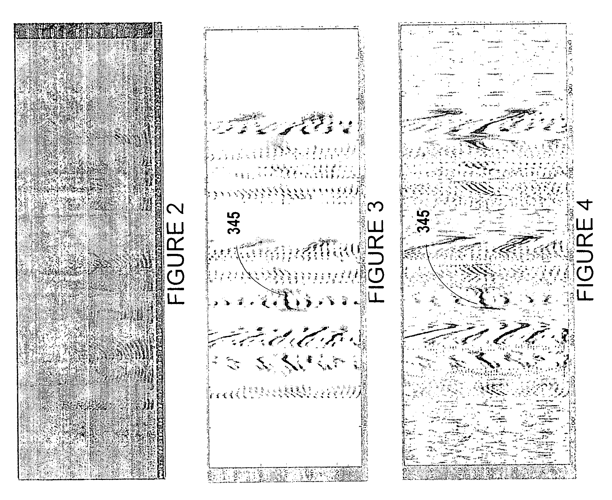 Adaptive filter pitch extraction