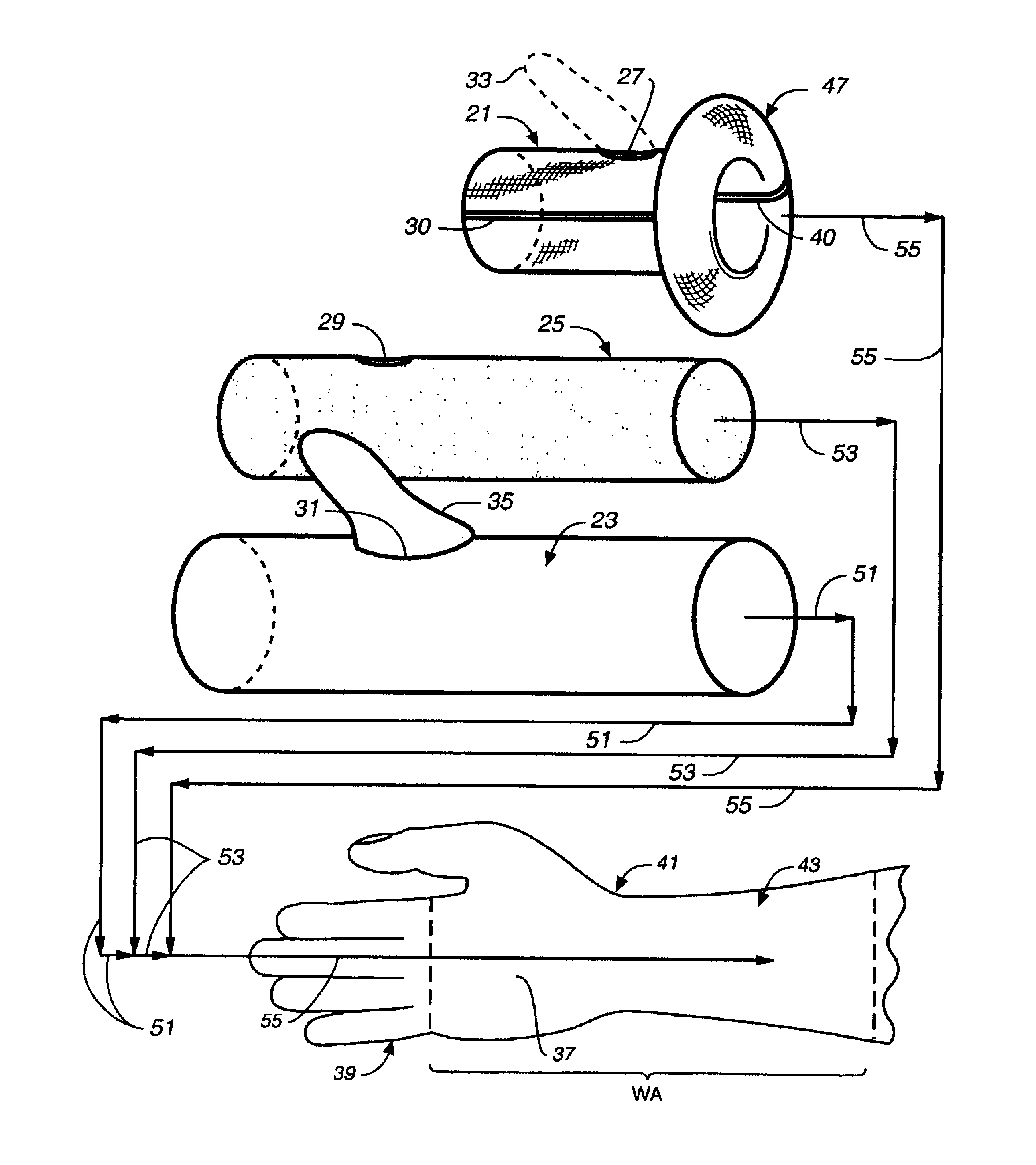 Custom molded wrist area impression kit and method