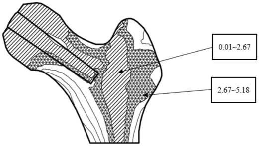 A biomimetic surface hip prosthesis with high long-term stability