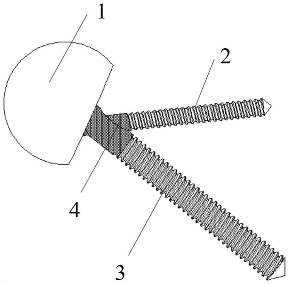 A biomimetic surface hip prosthesis with high long-term stability