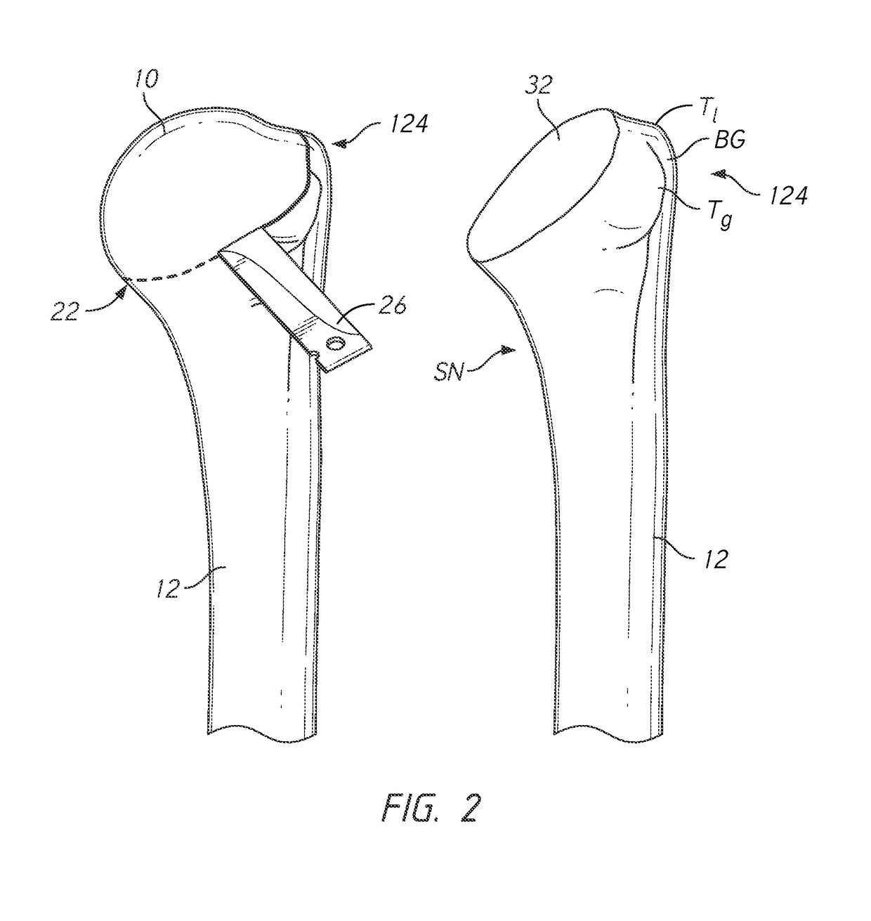 Patient specific humeral cutting guides