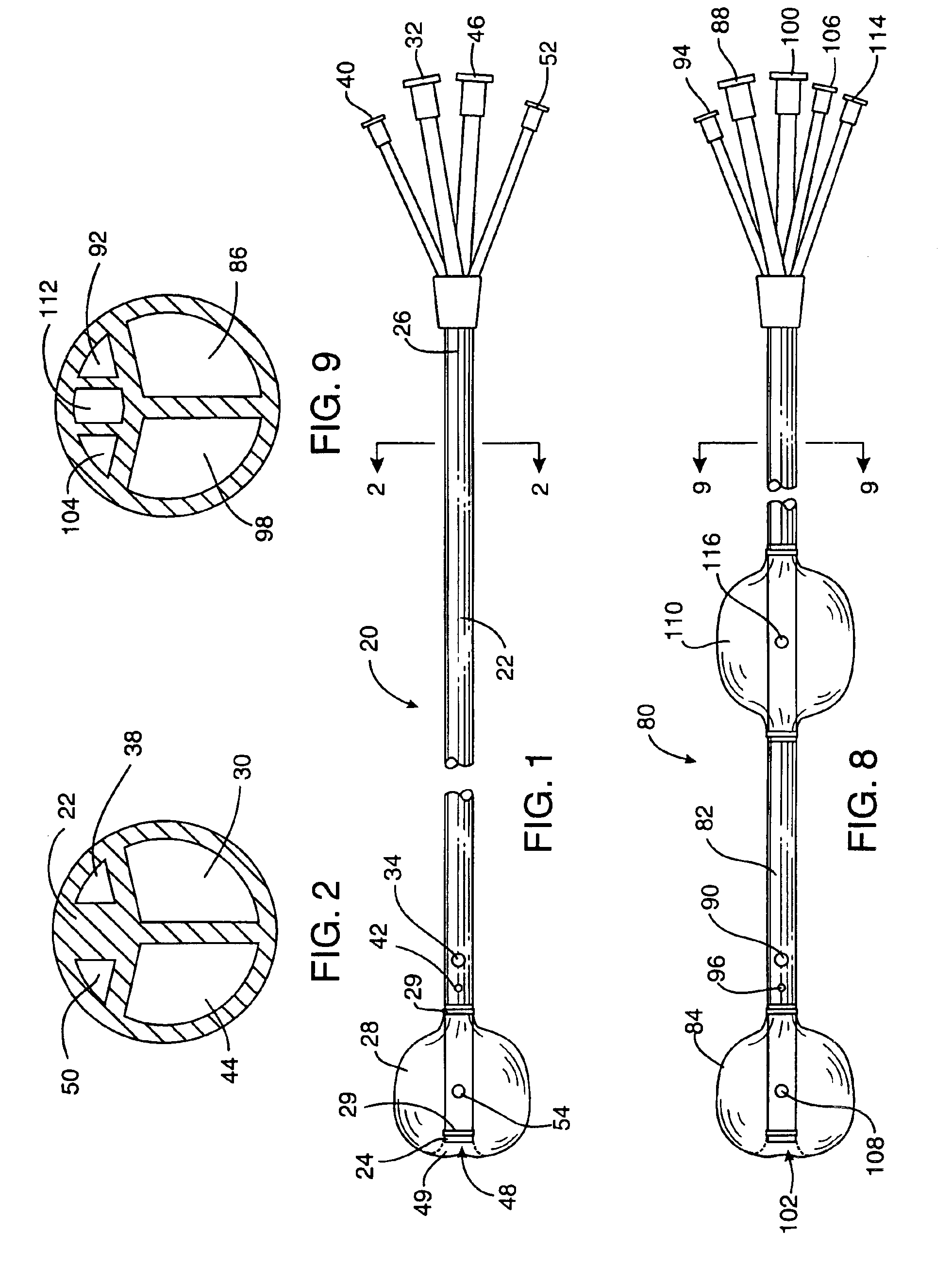 Antegrade cardioplegia catheter and method