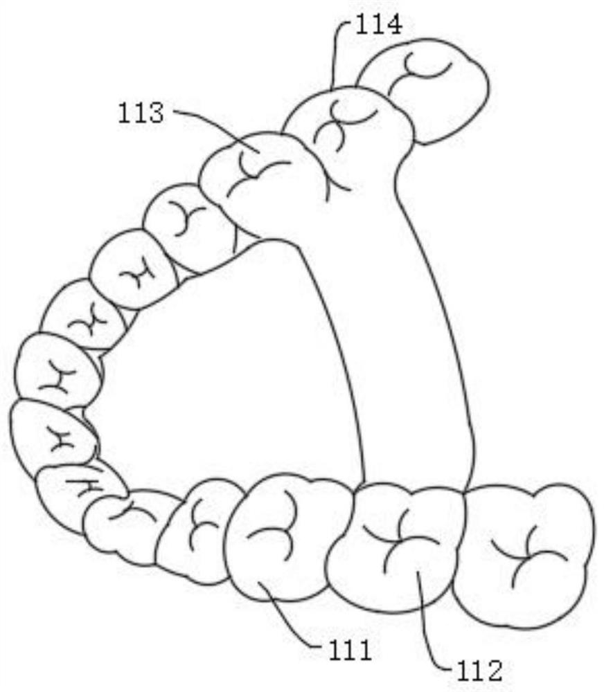 Design and manufacture of orthodontic appliances