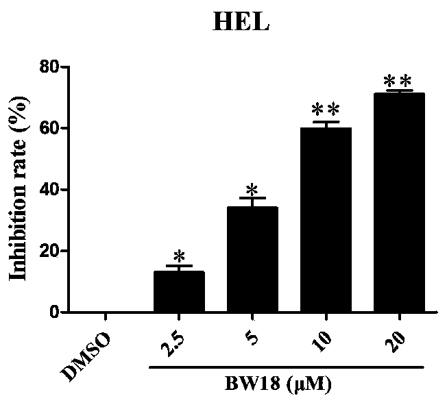 Application of bifid pregnane-type steroid compound in preparation of medicine for resisting erythroleukemia