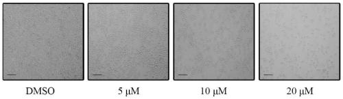 Application of bifid pregnane-type steroid compound in preparation of medicine for resisting erythroleukemia