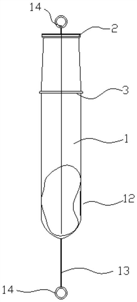 Continuous refrigeration system for kidney transplantation operation