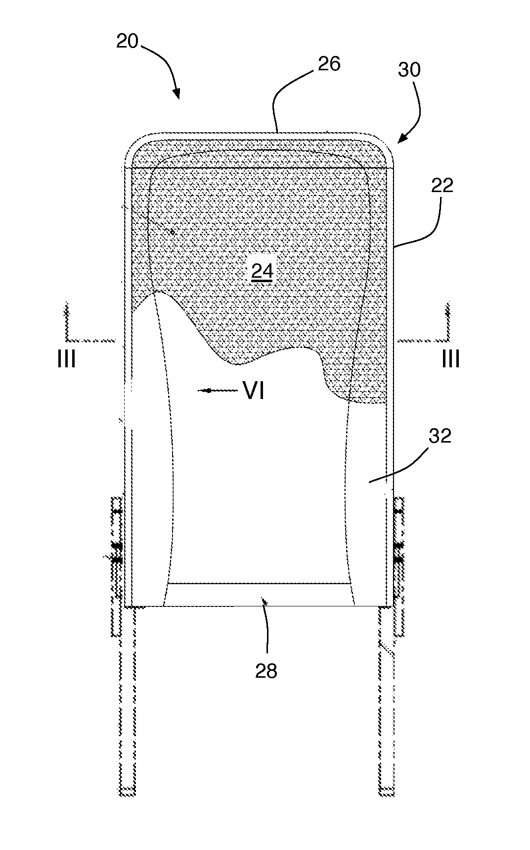 Aircraft seat back assembly