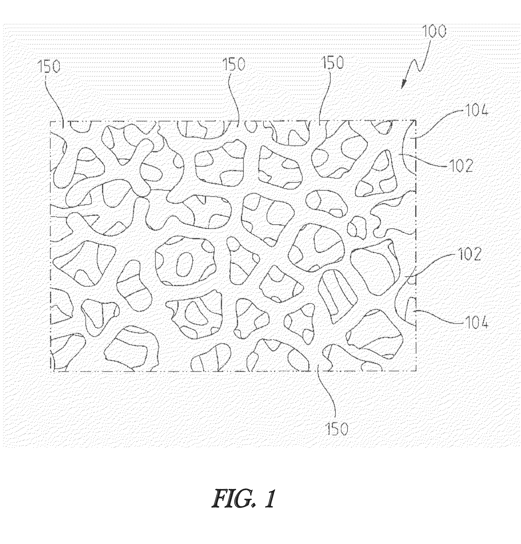 Porous metal device for regenerating soft tissue-to-bone interface