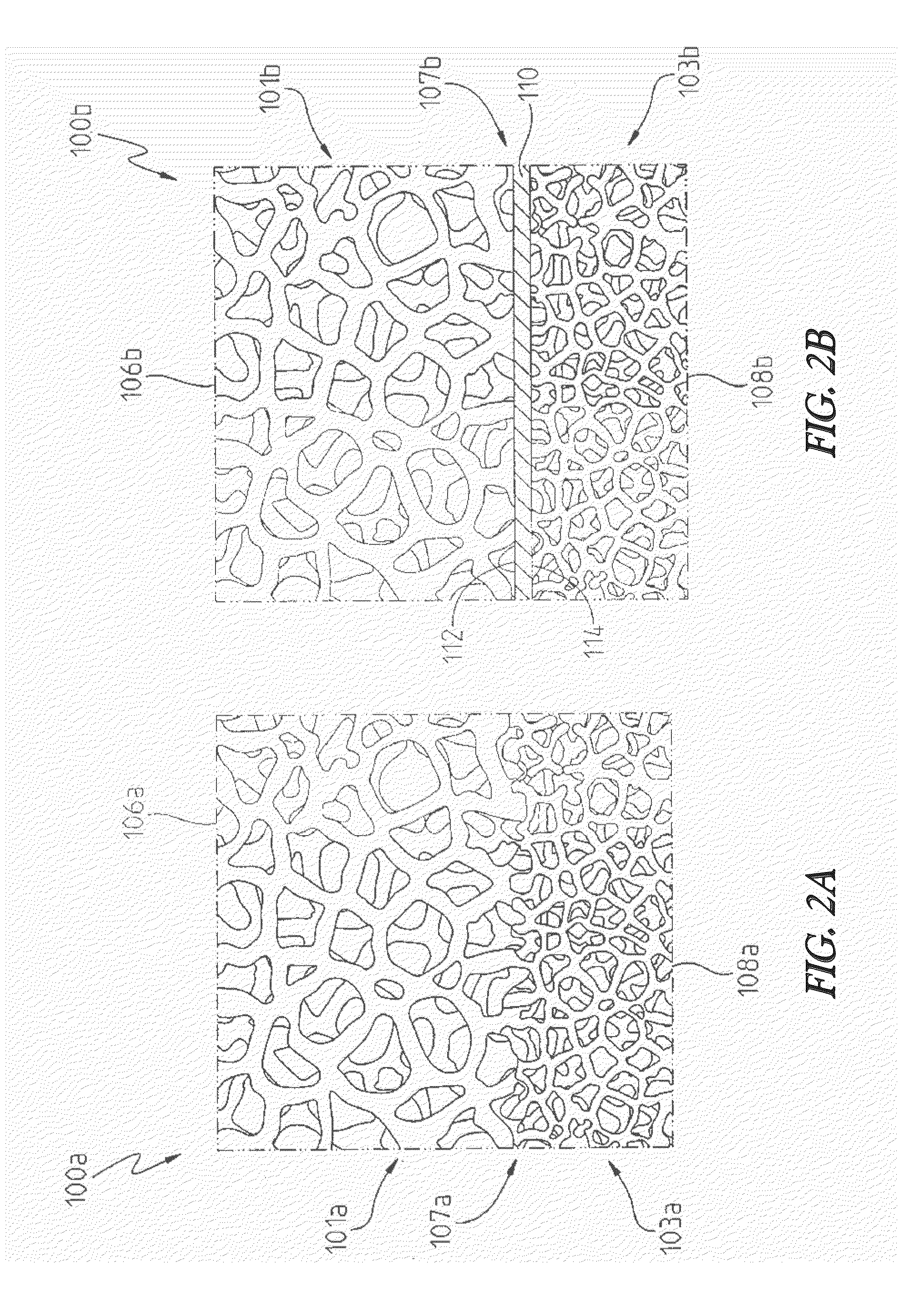 Porous metal device for regenerating soft tissue-to-bone interface