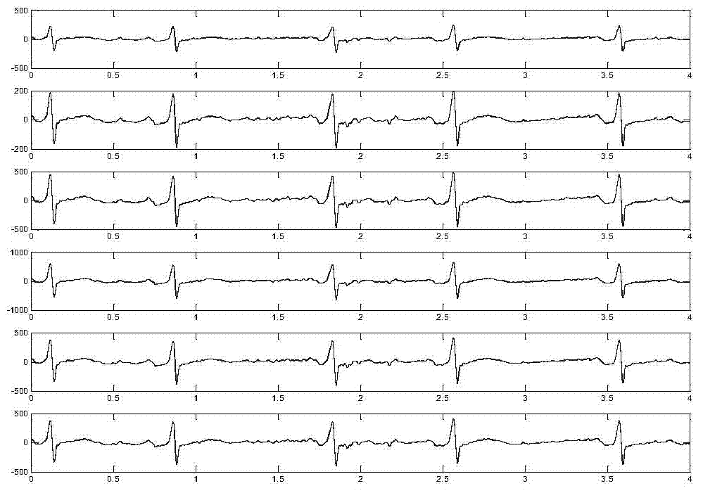 Fetal electrocardiogram detection method based on constraint blind source separation