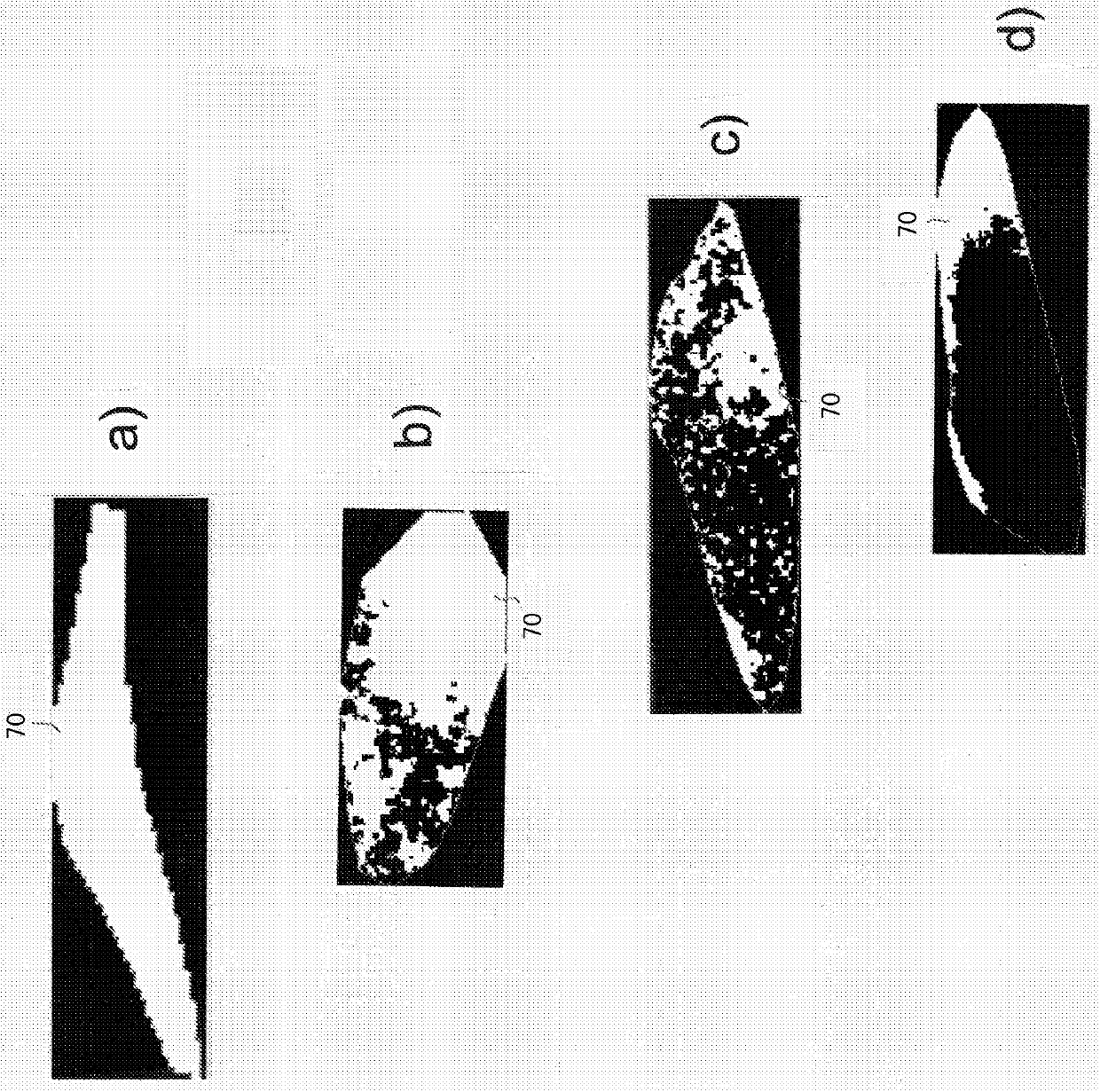 Evaluation of carotid plaque using contrast-enhanced ultrasound imaging