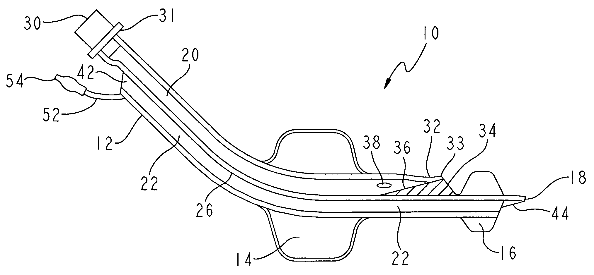 Non-tracheal ventilation tube