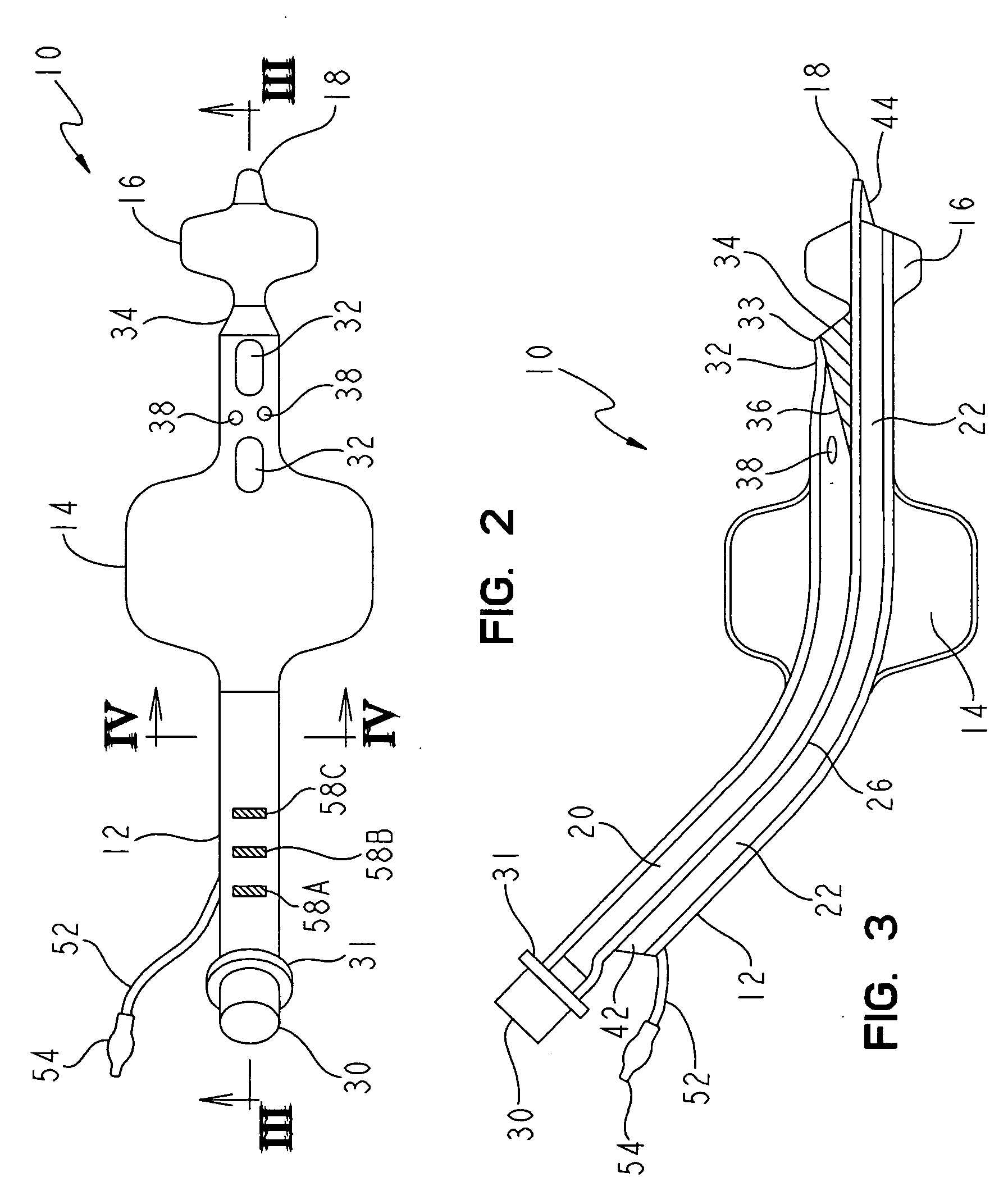 Non-tracheal ventilation tube