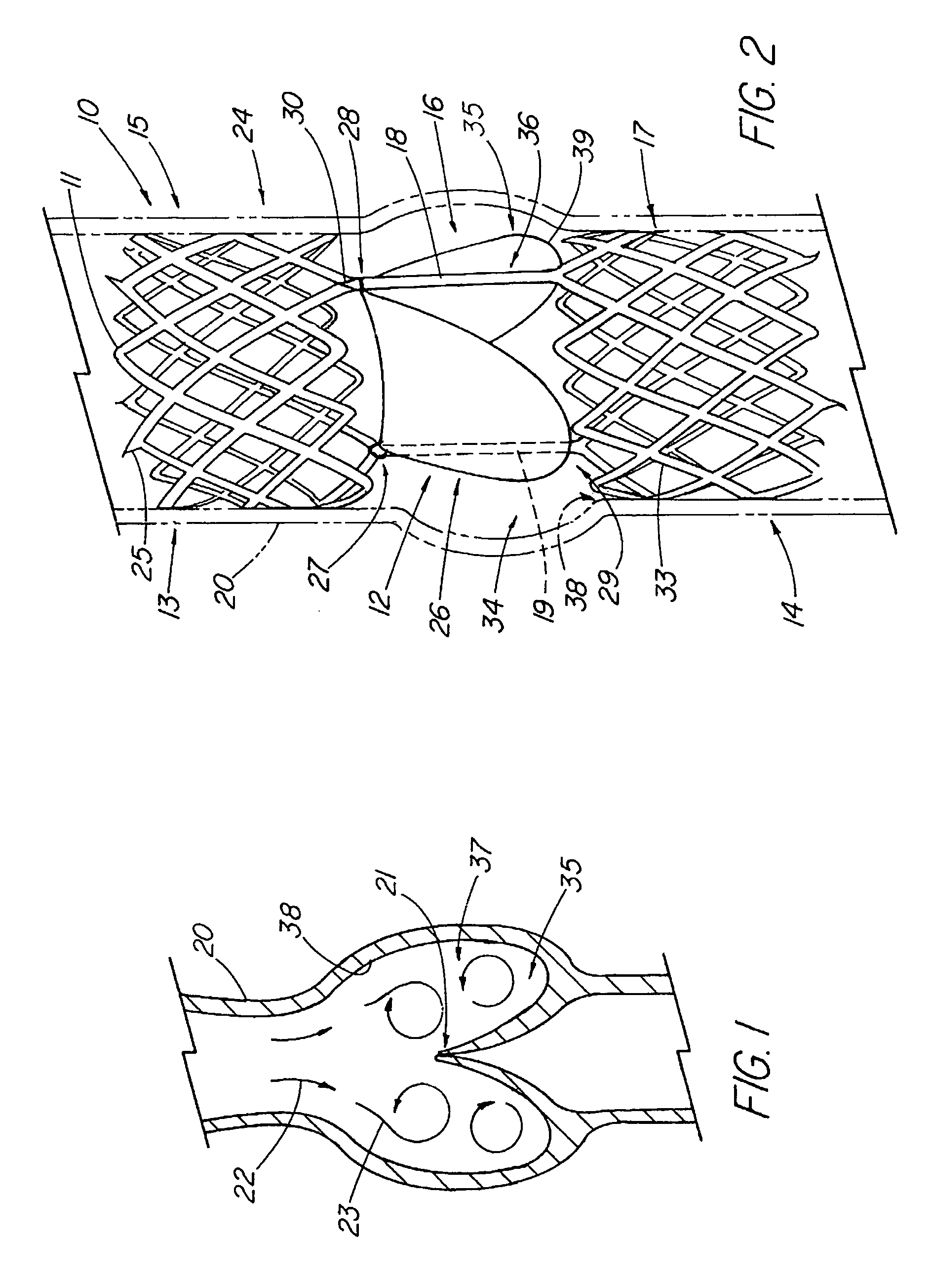 Artificial valve prosthesis with improved flow dynamics