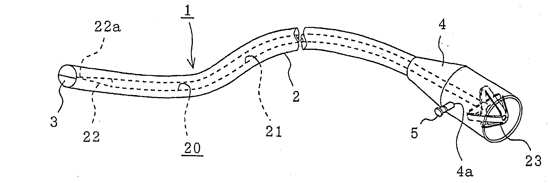 Infection-Preventing Gastrostomy Catheter Kit for Gastrostomy