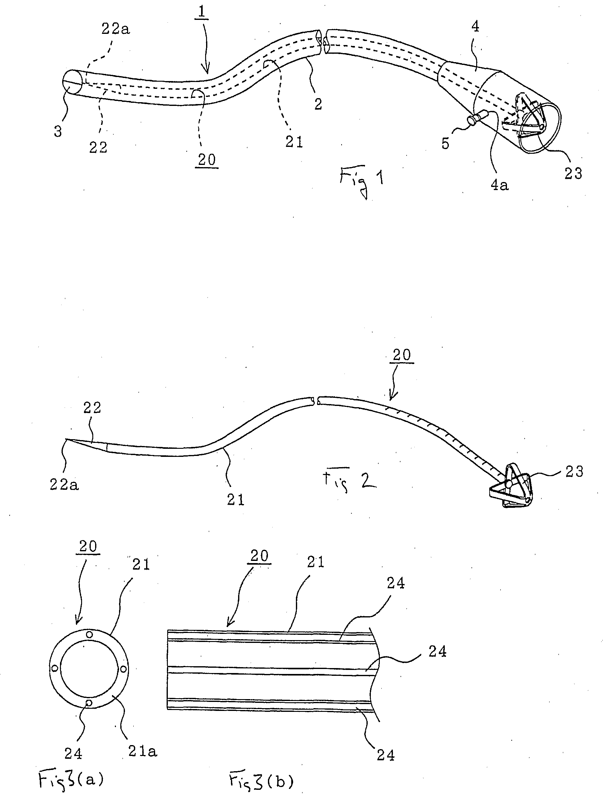 Infection-Preventing Gastrostomy Catheter Kit for Gastrostomy