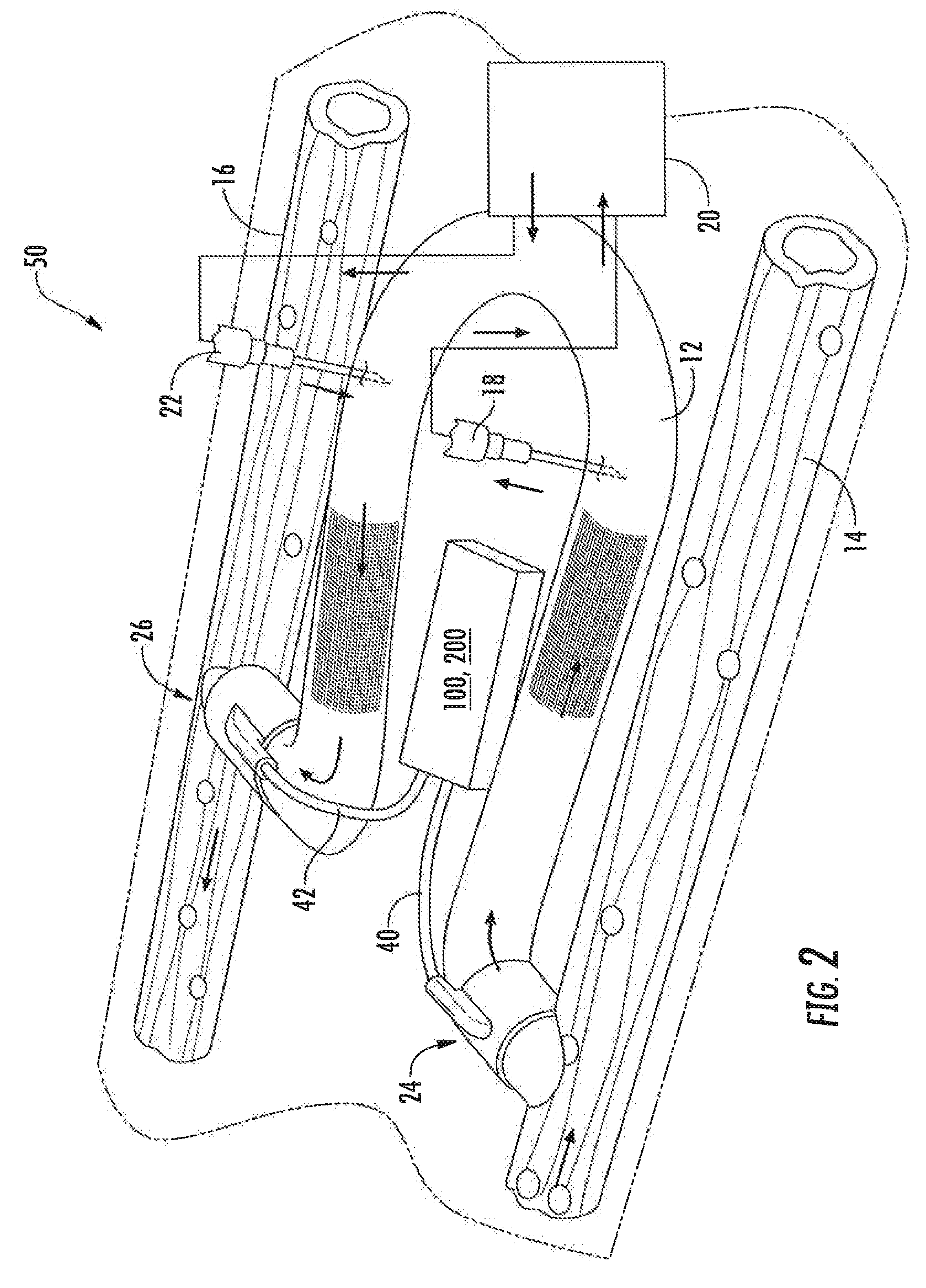 Magnetically activated arteriovenous access valve system and related methods