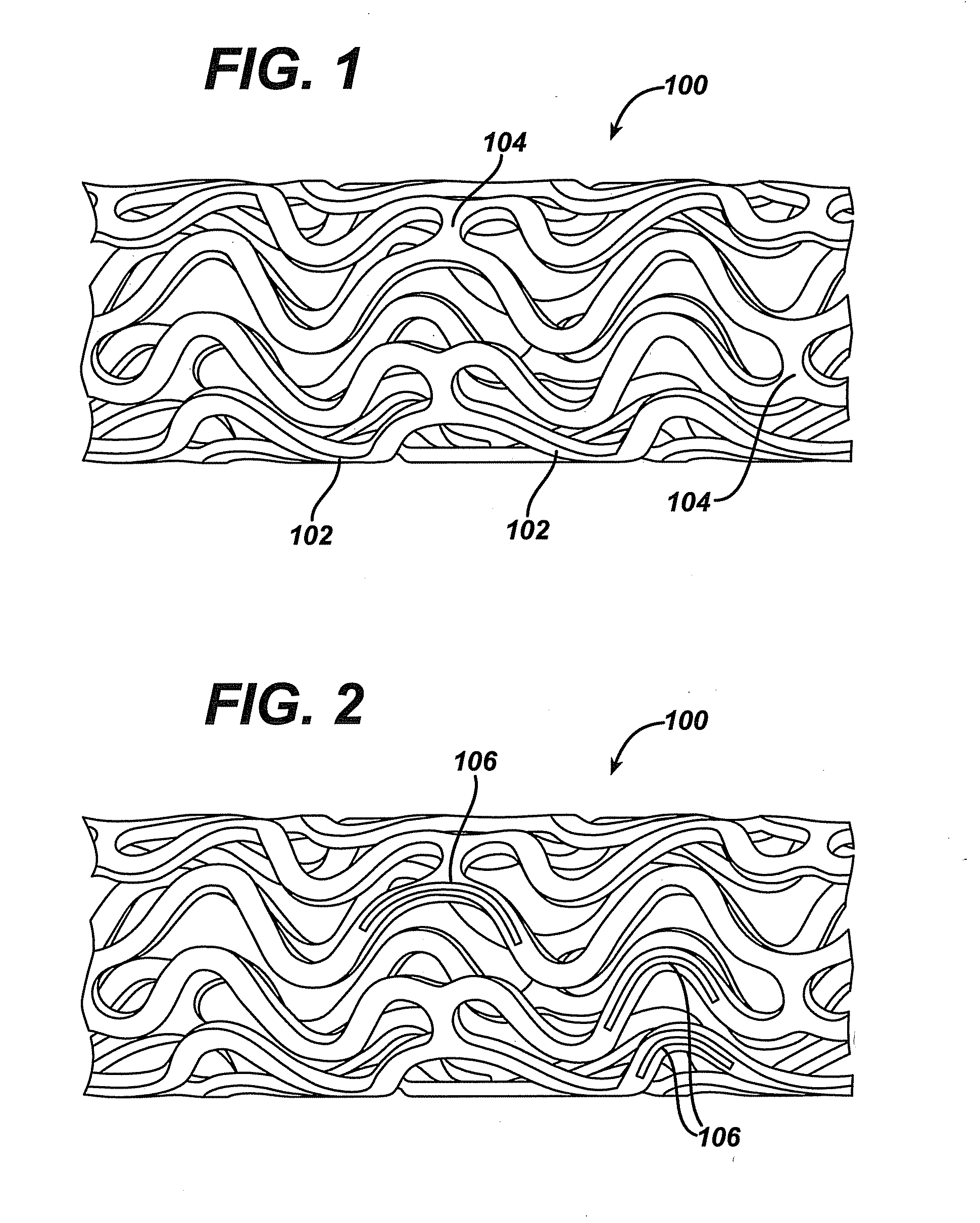 Bare metal stent with drug eluting reservoirs