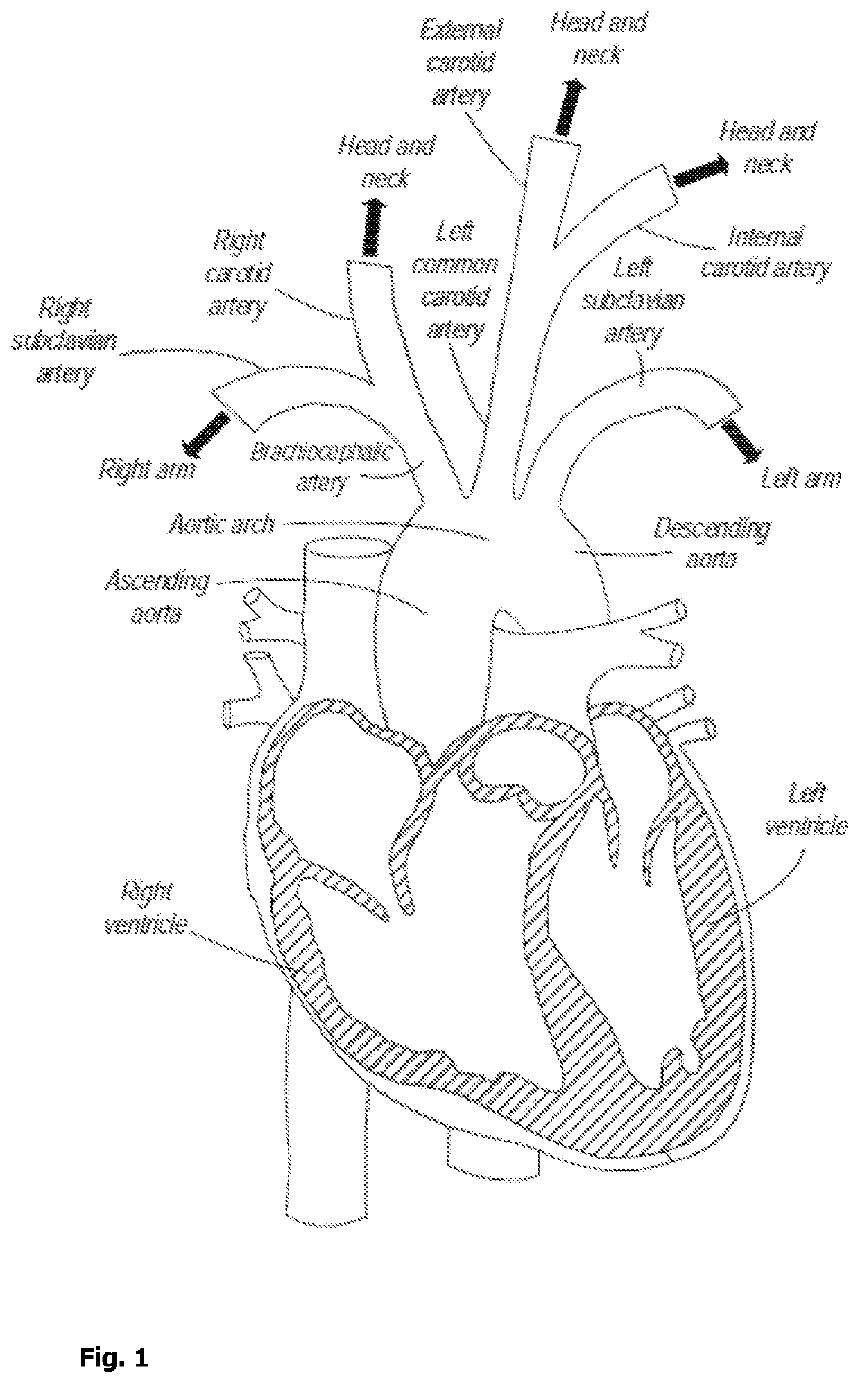 A device and diagnostic method for assessing and monitoring cognitive decline