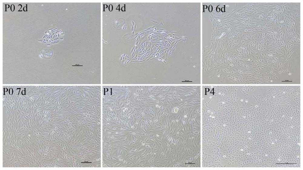 Establishment method of urine cell induced pluripotent stem cells of acute kidney injury patient