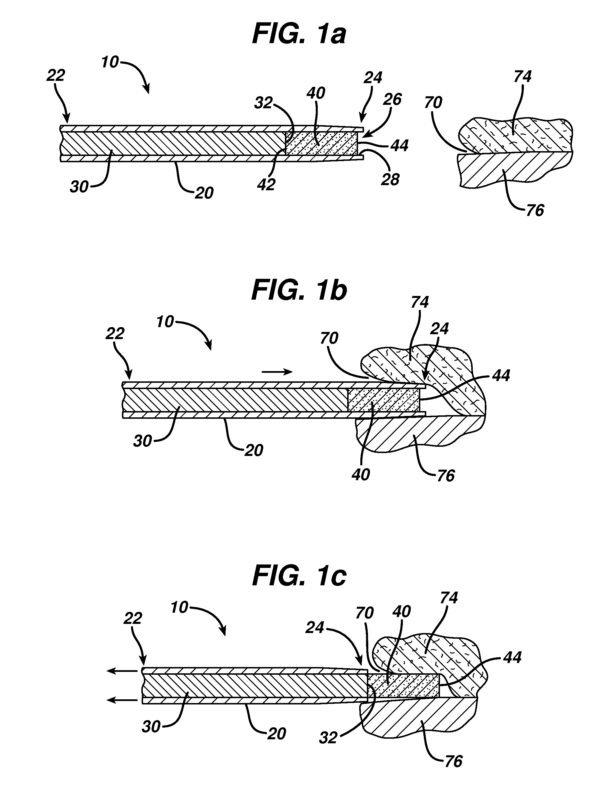 Device for delivering medicinal implants