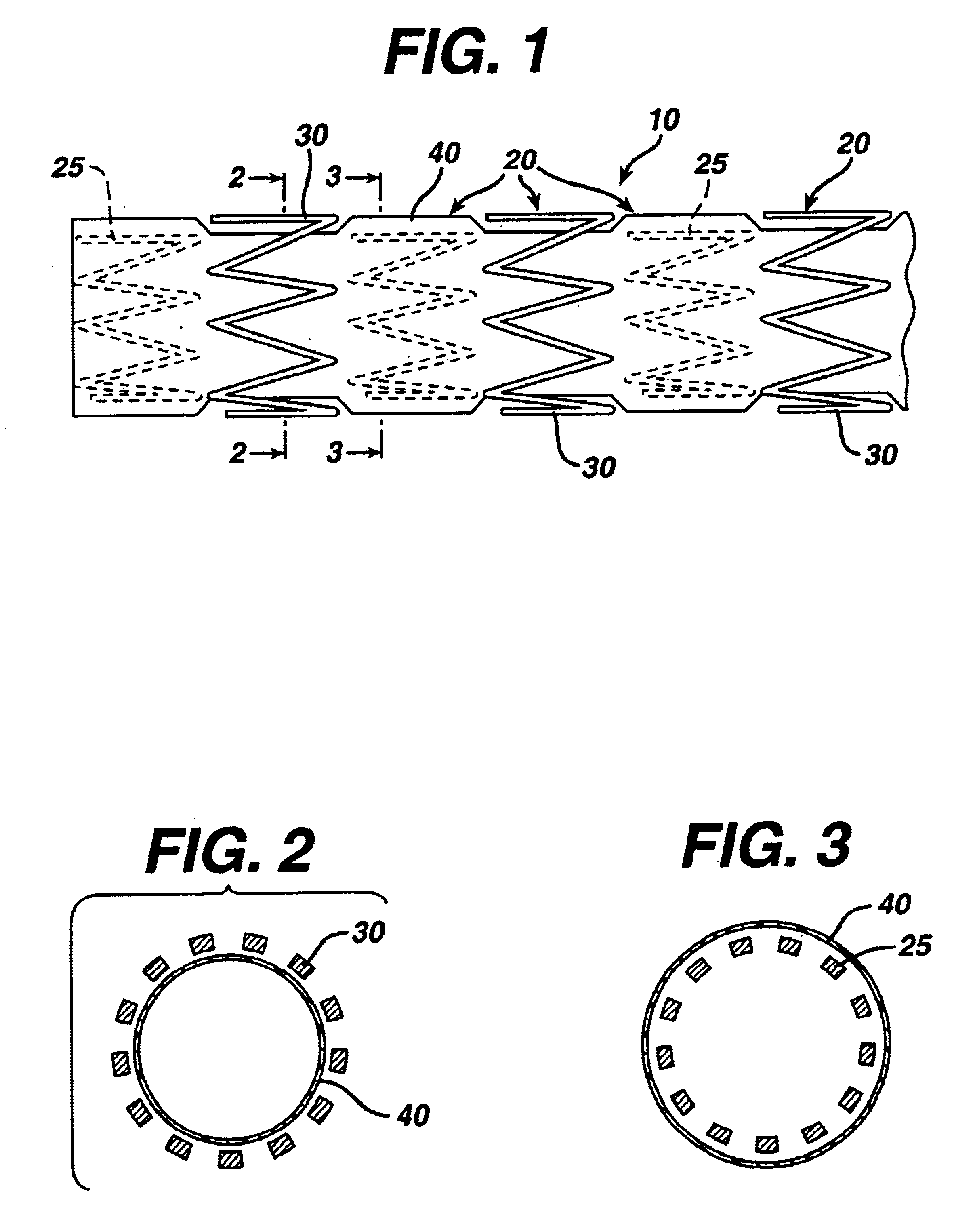 Covered segmented stent