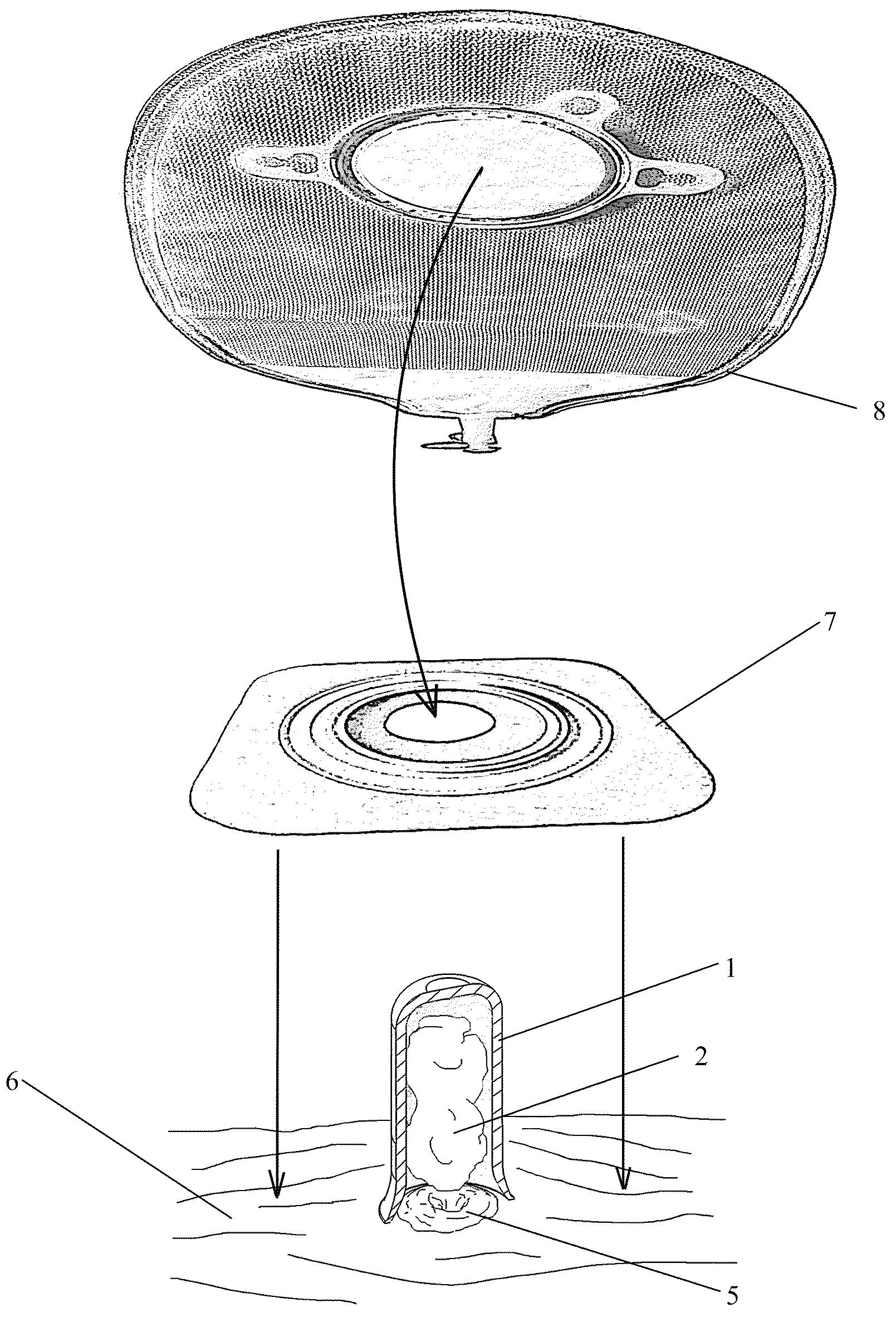 Stoma Cap Device for Ostomy Maintenance Assistance