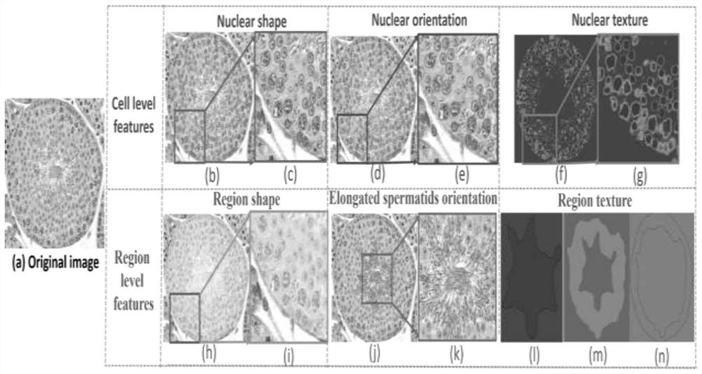 Automatic mouse spermatogenic tube staging system based on tissue morphological analysis