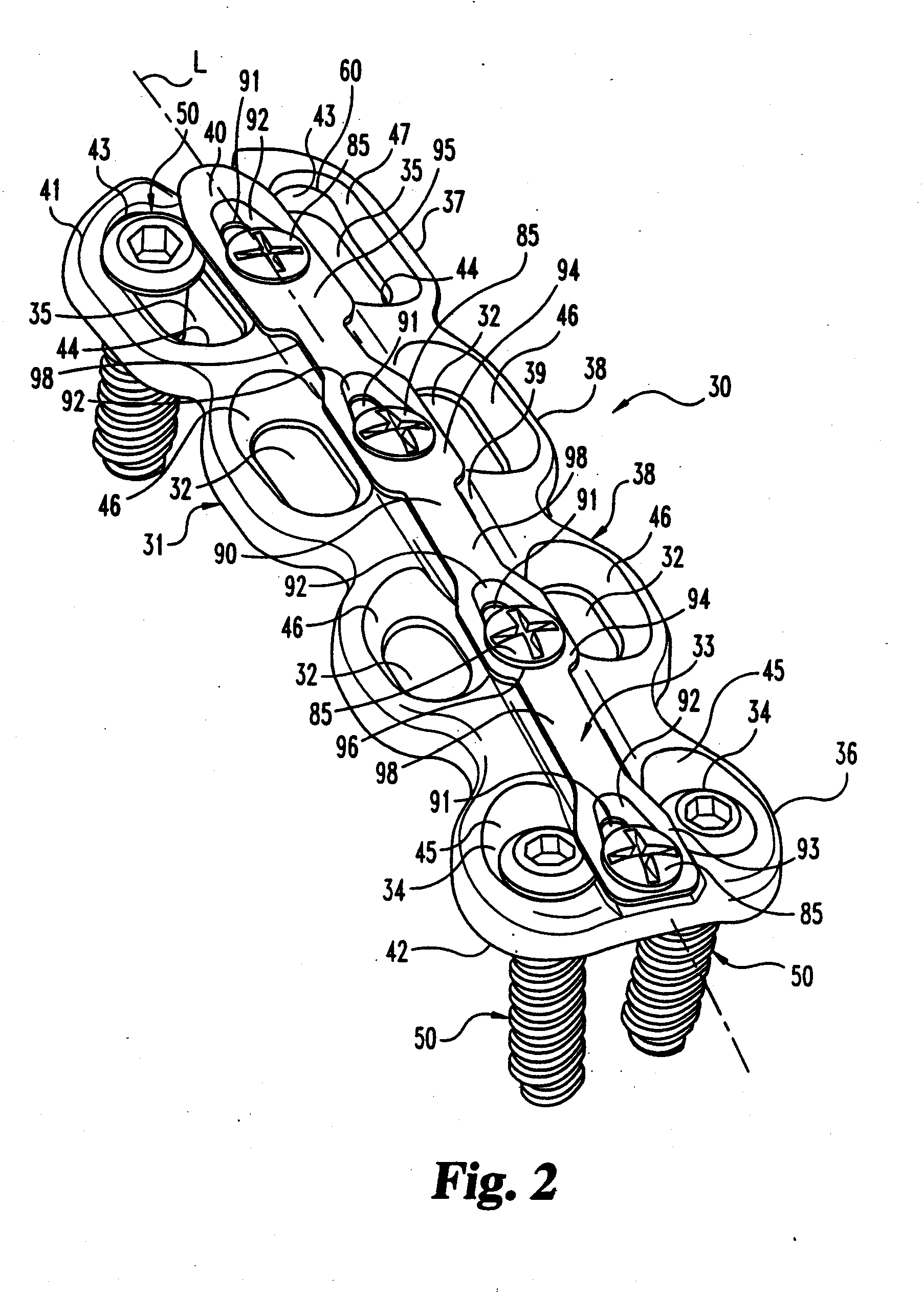 Anterior cervical plating system and method