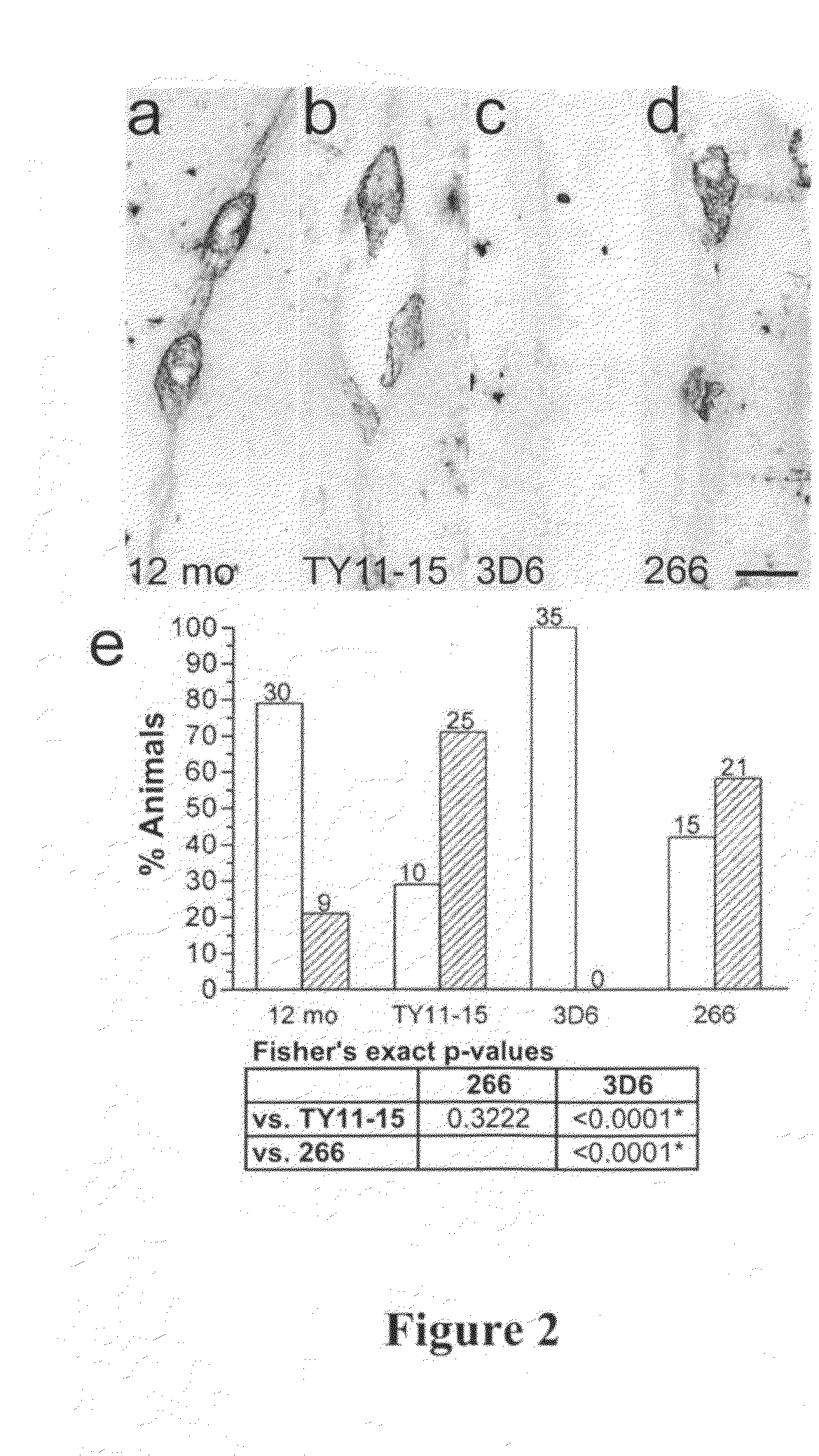 Treatment of cerebral amyloid angiopathy