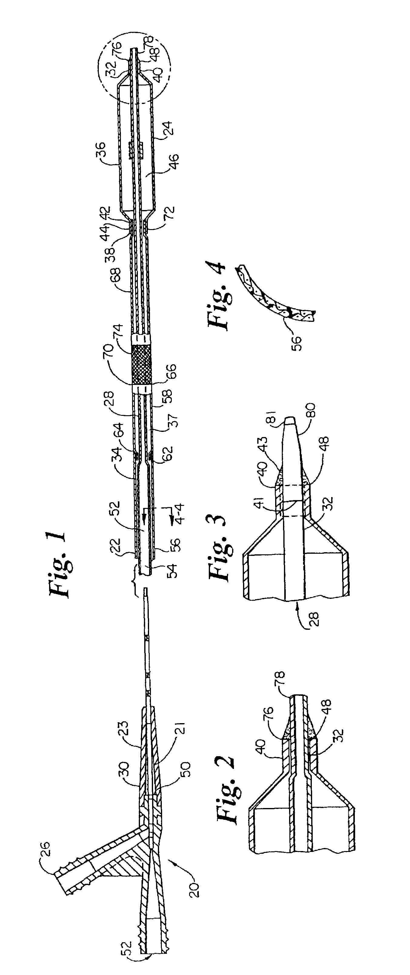 Catheter with spiral cut transition member