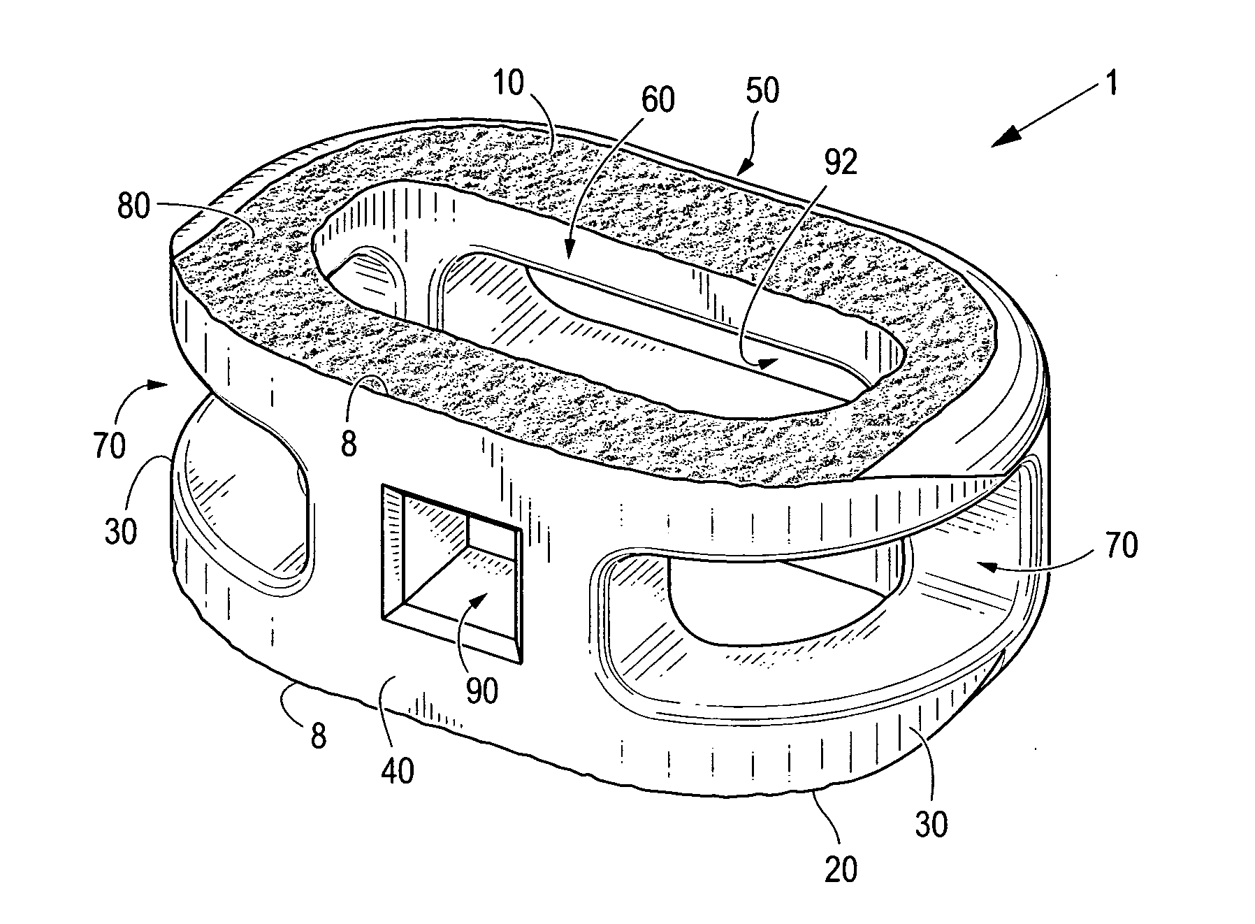 Composite interbody spinal implant having openings of predetermined size and shape