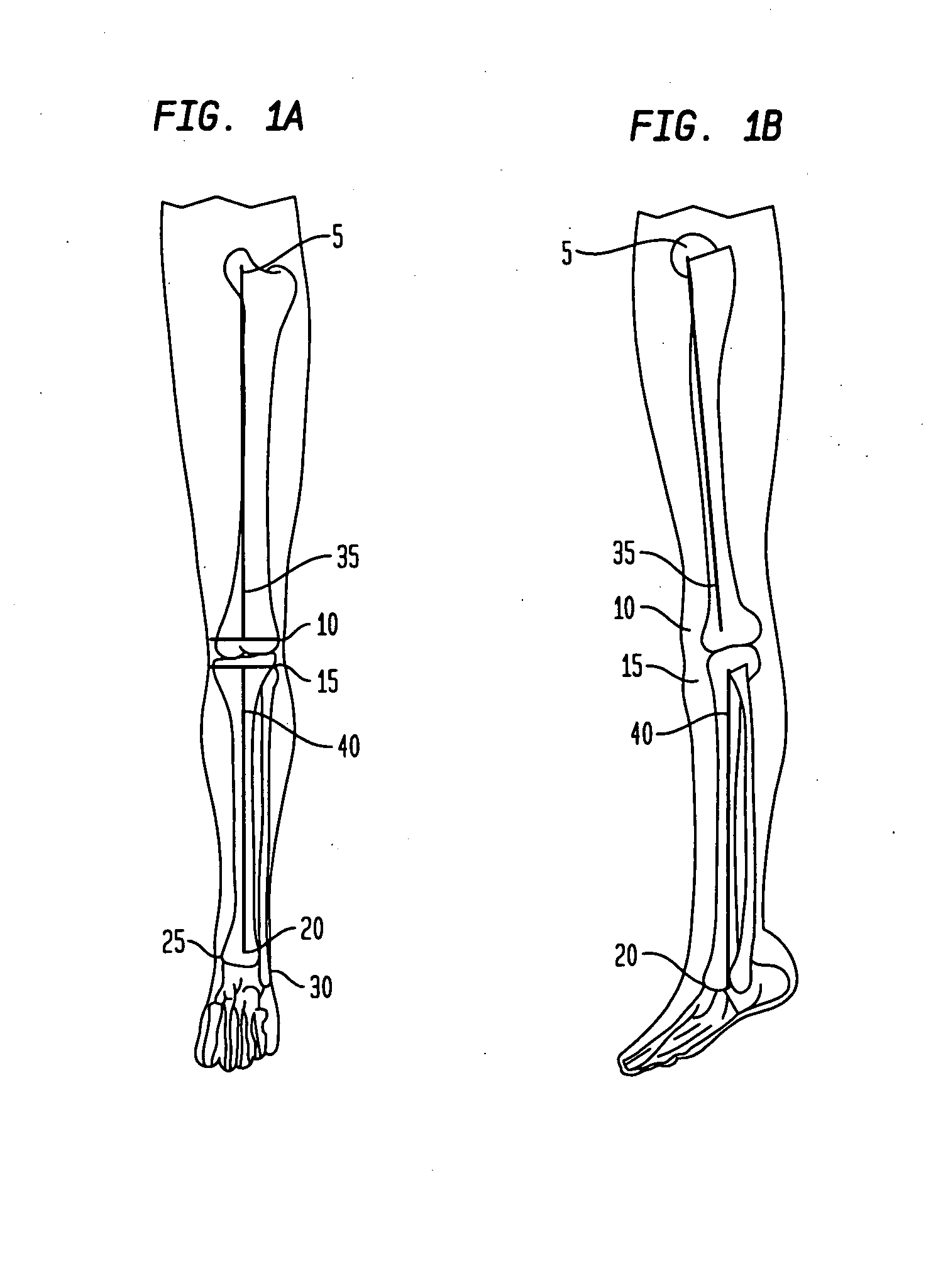 System and method for performing femoral sizing through navigation