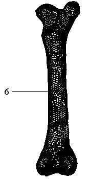 Three-dimensional finite element constructing method based on medical image data LISS-DF to cure distal femur fracture