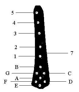 Three-dimensional finite element constructing method based on medical image data LISS-DF to cure distal femur fracture